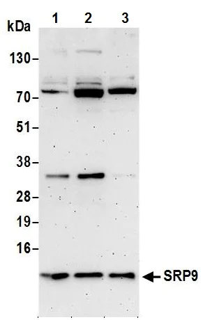 Western blot - Anti-SRP9 antibody (AB241989)