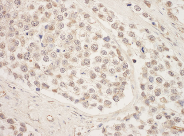 Immunohistochemistry (Formalin/PFA-fixed paraffin-embedded sections) - Anti-SRPK1 antibody (AB90527)