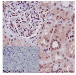 Immunohistochemistry (Formalin/PFA-fixed paraffin-embedded sections) - Anti-SRPK2 antibody [EPR16366] - BSA and Azide free (AB251113)