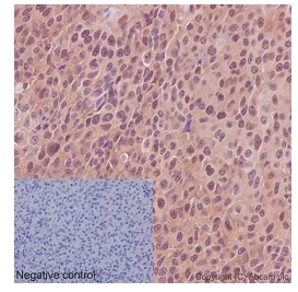 Immunohistochemistry (Formalin/PFA-fixed paraffin-embedded sections) - Anti-SRPK2 antibody [EPR16366] - BSA and Azide free (AB251113)