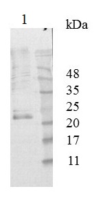 Western blot - Anti-SRPP antibody [10] (AB138711), expandable thumbnail