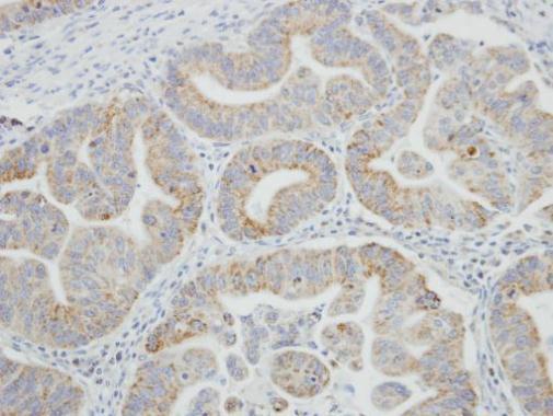 Immunohistochemistry (Formalin/PFA-fixed paraffin-embedded sections) - Anti-SRPR alpha antibody (AB228625)