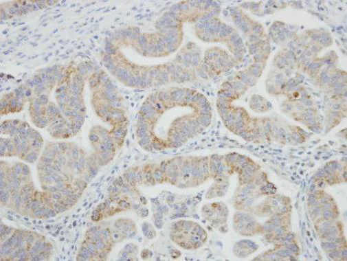 Immunohistochemistry (Formalin/PFA-fixed paraffin-embedded sections) - Anti-SRPR alpha antibody (AB228625)