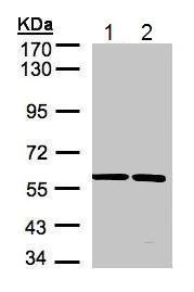 Western blot - Anti-SRPR alpha antibody (AB228625)