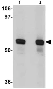 Western blot - Anti-SRPX2 antibody (AB91584)
