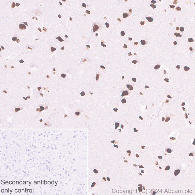 Immunohistochemistry (Formalin/PFA-fixed paraffin-embedded sections) - Anti-SRRM2 antibody [EPR28620-54] (AB317817)
