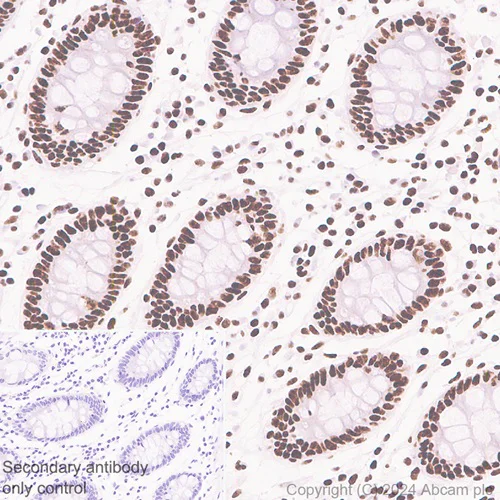 Immunohistochemistry (Formalin/PFA-fixed paraffin-embedded sections) - Anti-SRRM2 antibody [EPR28620-54] (AB317817)