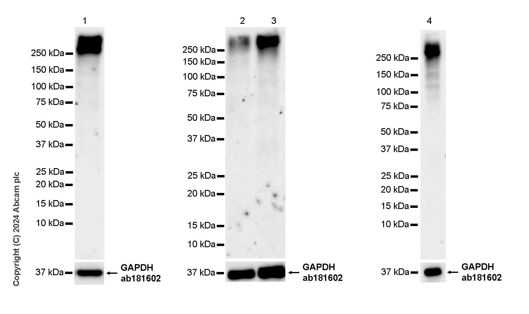 Anti-SRRM2 antibody [EPR28620-54]