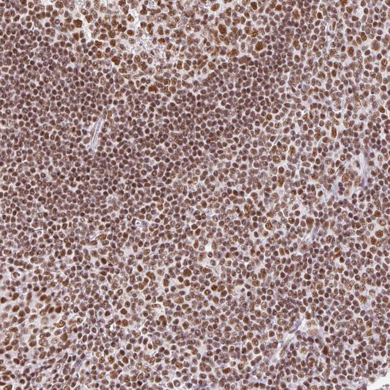 Immunohistochemistry (Formalin/PFA-fixed paraffin-embedded sections) - Anti-SRSF10 antibody (AB254935)
