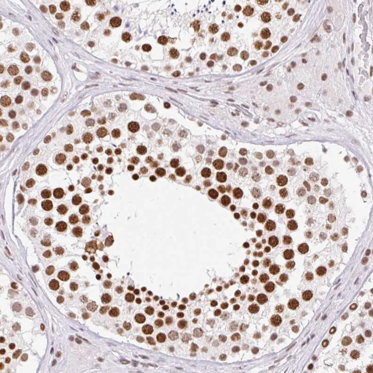 Immunohistochemistry (Formalin/PFA-fixed paraffin-embedded sections) - Anti-SRSF10 antibody (AB254935)