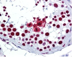 Immunohistochemistry (Formalin/PFA-fixed paraffin-embedded sections) - Anti-SRSF3 antibody (AB125124)