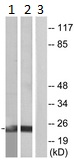 Western blot - Anti-SRSF3 antibody (AB125124), expandable thumbnail
