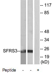 Western blot - Anti-SRSF3 antibody (AB73891), expandable thumbnail