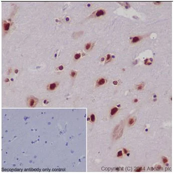 Immunohistochemistry (Formalin/PFA-fixed paraffin-embedded sections) - Anti-SRSF3 antibody [EPR16976] (AB198291)