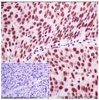 Immunohistochemistry (Formalin/PFA-fixed paraffin-embedded sections) - Anti-SRSF3 antibody [EPR16976] - BSA and Azide free (AB251252)