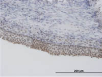 Immunohistochemistry (Formalin/PFA-fixed paraffin-embedded sections) - Anti-SRSF5 antibody (AB67175)