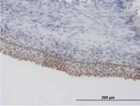 Immunohistochemistry (Formalin/PFA-fixed paraffin-embedded sections) - Anti-SRSF5 antibody (AB67175)