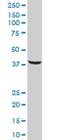 Western blot - Anti-SRSF5 antibody (AB67175)