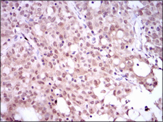 Immunohistochemistry (Formalin/PFA-fixed paraffin-embedded sections) - Anti-SRY/TDF antibody [1G4] (AB135239), expandable thumbnail