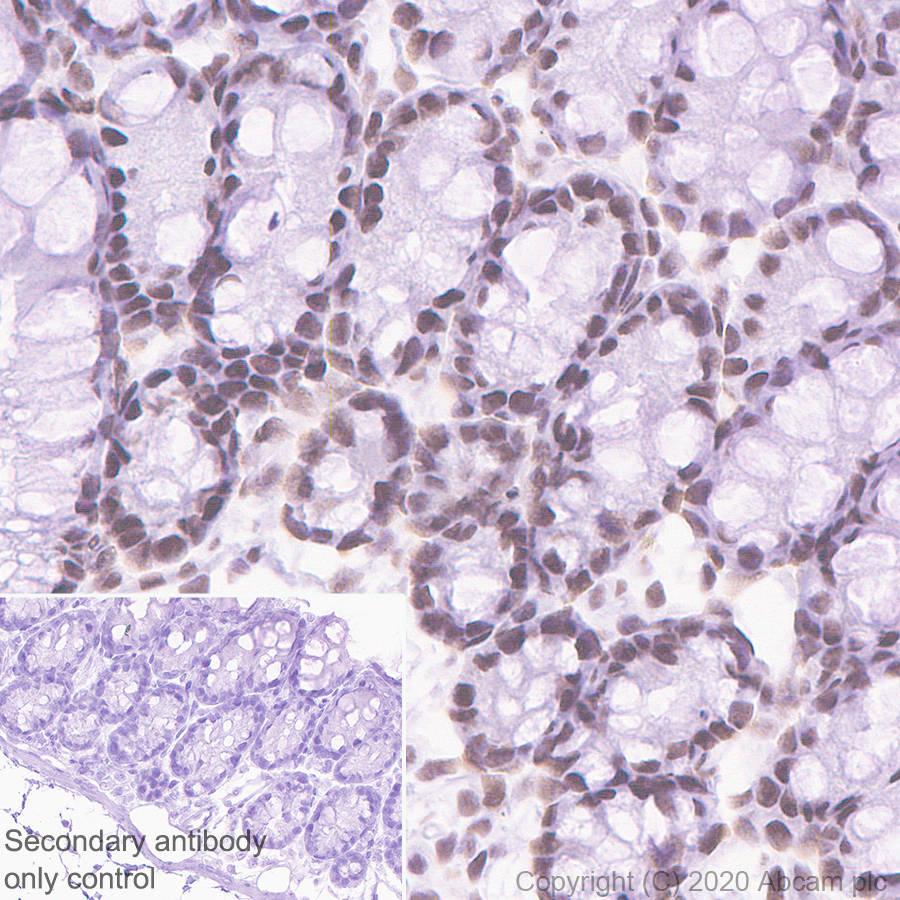 Immunohistochemistry (Formalin/PFA-fixed paraffin-embedded sections) - Anti-SS18 antibody [EPR23636-98] (ab254405), expandable thumbnail