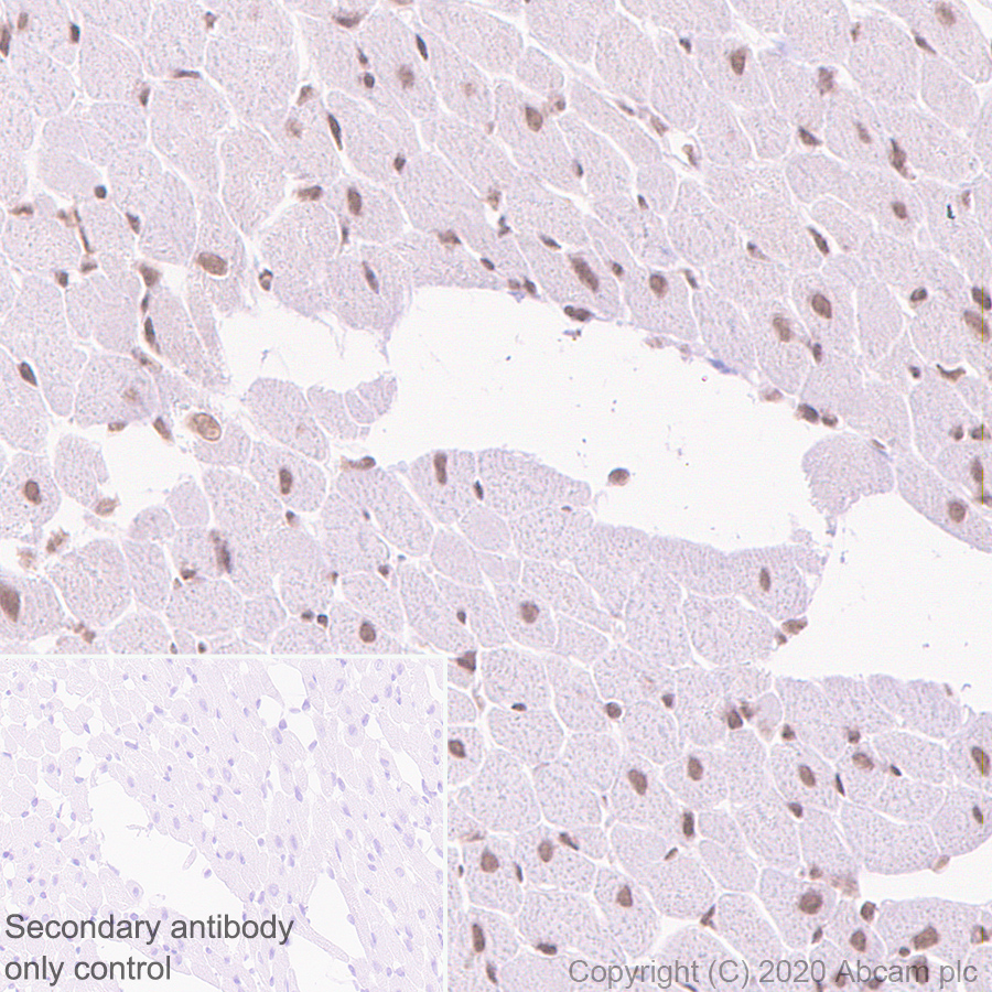 Immunohistochemistry (Formalin/PFA-fixed paraffin-embedded sections) - Anti-SS18 antibody [EPR23636-98] (ab254405), expandable thumbnail