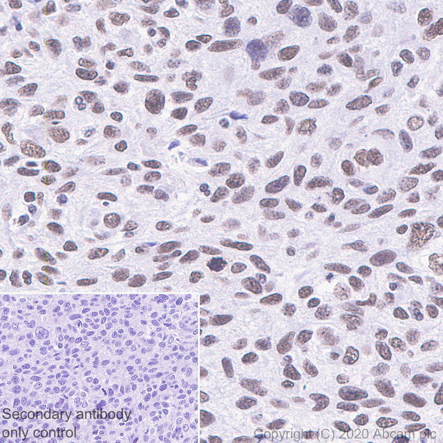 Immunohistochemistry (Formalin/PFA-fixed paraffin-embedded sections) - Anti-SS18 antibody [EPR23636-98] - BSA and Azide free (AB278050)