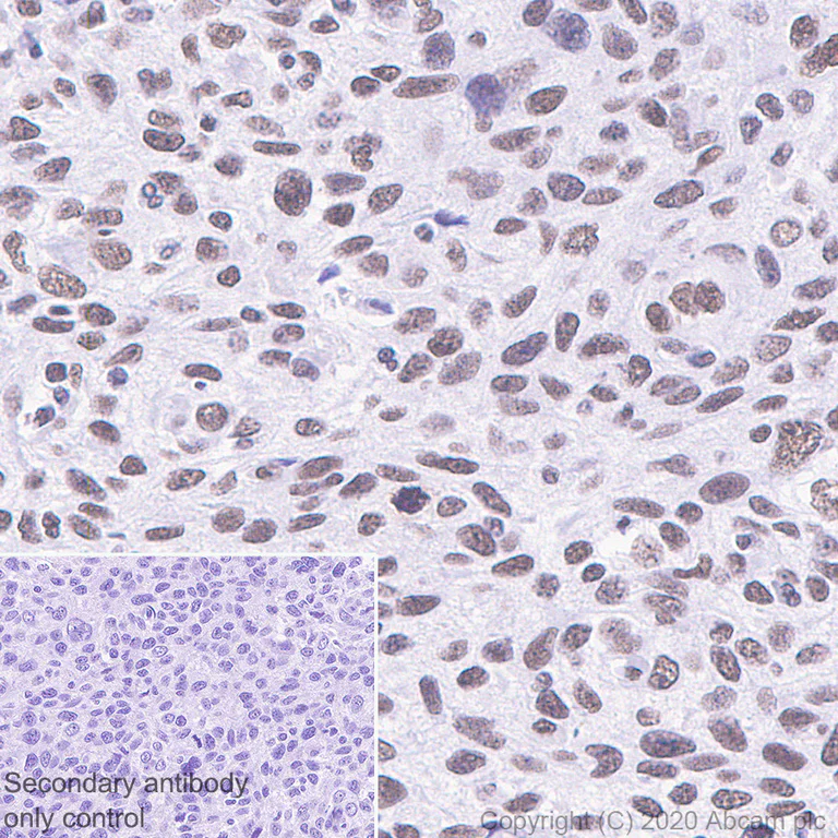 Immunohistochemistry (Formalin/PFA-fixed paraffin-embedded sections) - Anti-SS18 antibody [EPR23636-98] - BSA and Azide free (AB278050)