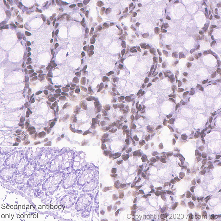 Immunohistochemistry (Formalin/PFA-fixed paraffin-embedded sections) - Anti-SS18 antibody [EPR23636-98] - BSA and Azide free (AB278050)
