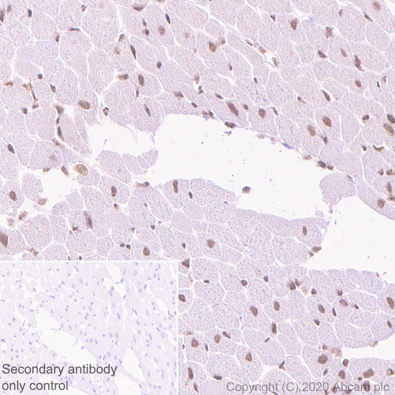 Immunohistochemistry (Formalin/PFA-fixed paraffin-embedded sections) - Anti-SS18 antibody [EPR23636-98] - BSA and Azide free (AB278050)