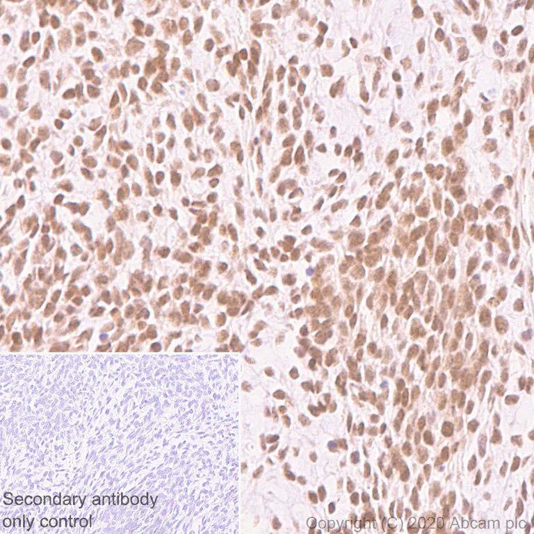 Immunohistochemistry (Formalin/PFA-fixed paraffin-embedded sections) - Anti-SS18 antibody [EPR23636-98] - BSA and Azide free (AB278050)