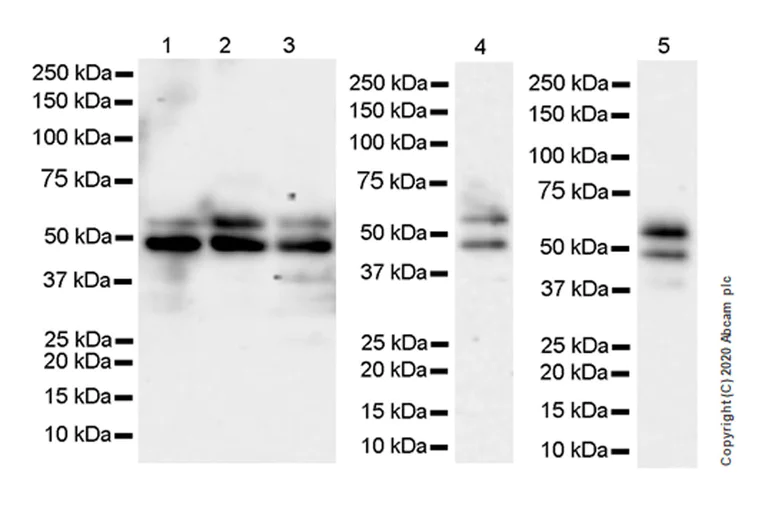 Western blot - Anti-SS18 antibody [EPR23636-98] - BSA and Azide free (AB278050)