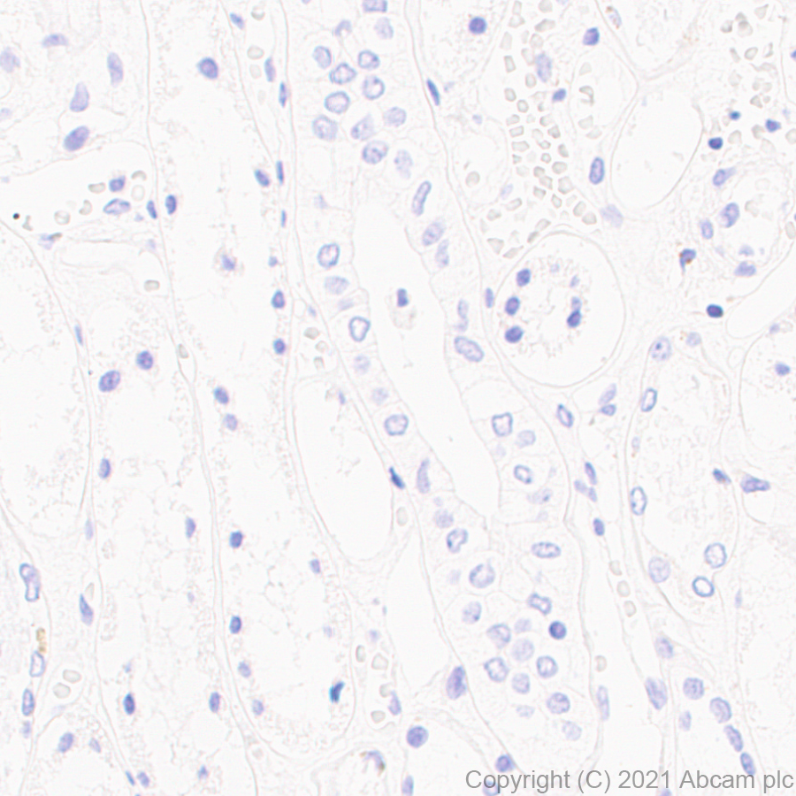 Immunohistochemistry (Formalin/PFA-fixed paraffin-embedded sections) - Anti-SS18-SSX Fusion Protein antibody [EPR24159-81] (AB254406)