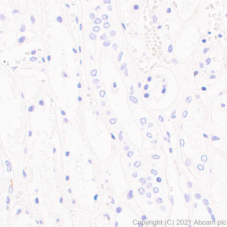 Immunohistochemistry (Formalin/PFA-fixed paraffin-embedded sections) - Anti-SS18-SSX Fusion Protein antibody [EPR24159-81] - BSA and Azide free (AB281565)