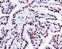 Immunohistochemistry (Formalin/PFA-fixed paraffin-embedded sections) - Anti-SSB antibody [EPR6570] (AB124932)