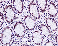 Immunohistochemistry (Formalin/PFA-fixed paraffin-embedded sections) - Anti-SSB antibody [EPR6570] (AB124932)