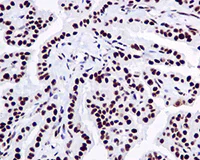 Immunohistochemistry (Formalin/PFA-fixed paraffin-embedded sections) - Anti-SSB antibody [EPR6570] - BSA and Azide free (AB232025)