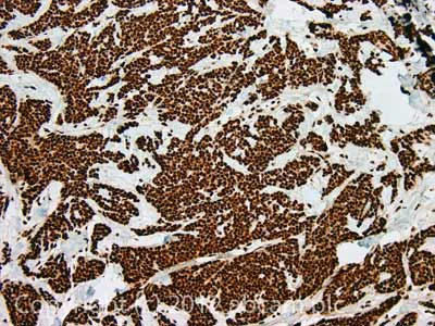 Immunohistochemistry (Formalin/PFA-fixed paraffin-embedded sections) - Anti-SSB antibody [mAbcam75927] (AB75927)