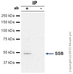 Immunoprecipitation - Anti-SSB antibody [mAbcam75927] (AB75927)