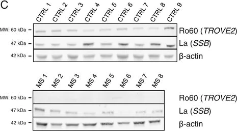 Western blot - Anti-SSB antibody [mAbcam75927] (AB75927)