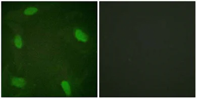 Immunocytochemistry/ Immunofluorescence - Anti-SSB (phospho S366) antibody (AB61800)