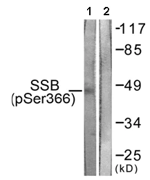 Western blot - Anti-SSB (phospho S366) antibody (AB61800)