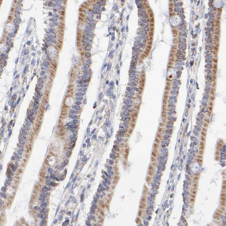 Immunohistochemistry (Formalin/PFA-fixed paraffin-embedded sections) - Anti-SSBP1 antibody (AB224053)