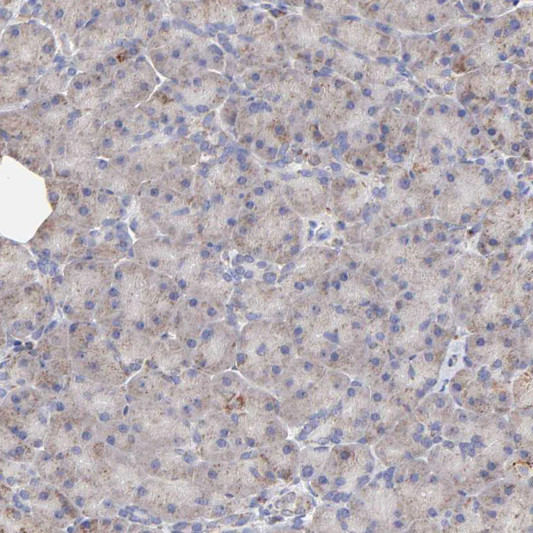 Immunohistochemistry (Formalin/PFA-fixed paraffin-embedded sections) - Anti-SSBP1 antibody (AB224053)