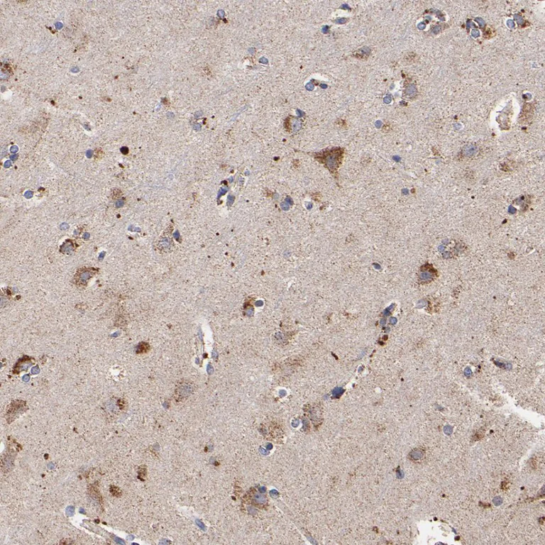 Immunohistochemistry (Formalin/PFA-fixed paraffin-embedded sections) - Anti-SSBP1 antibody (AB224053)