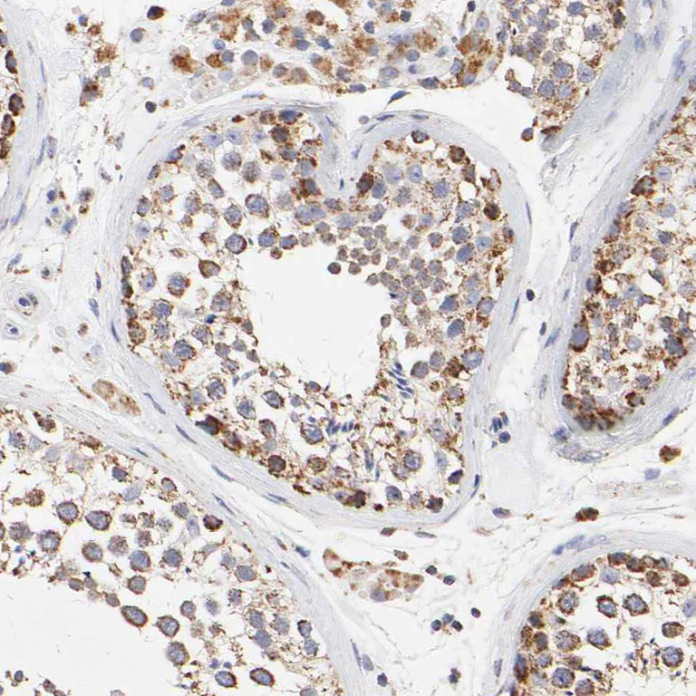 Immunohistochemistry (Formalin/PFA-fixed paraffin-embedded sections) - Anti-SSBP1 antibody (AB224053)