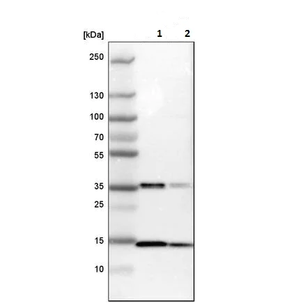 Western blot - Anti-SSBP1 antibody (AB224053)