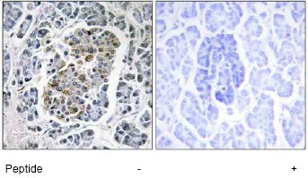 Immunohistochemistry (Formalin/PFA-fixed paraffin-embedded sections) - Anti-SSBP1 antibody (AB74710)