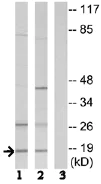 Western blot - Anti-SSBP1 antibody (AB74710)