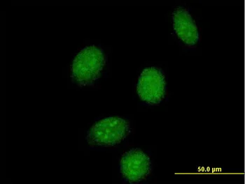 Immunocytochemistry/ Immunofluorescence - Anti-SSBP2 antibody (AB168273)