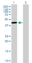 Western blot - Anti-SSBP2 antibody (AB168273)
